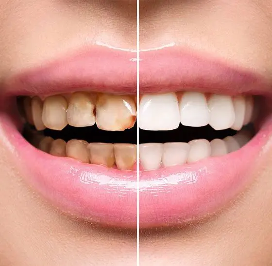 best dental clinic in Surat